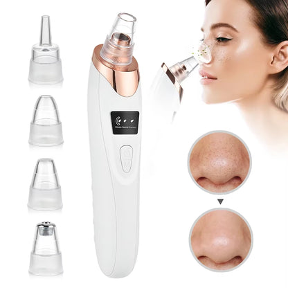 Revolutionary Blackhead Remover Vacuum: Your Ultimate Electric Face Cleaner for Pimple and Acne Removal